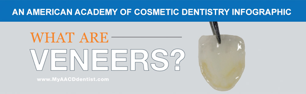 What are Veneers?